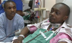 Chronic Kidney Disease: Causes, Early Signs, and Prevention Tips